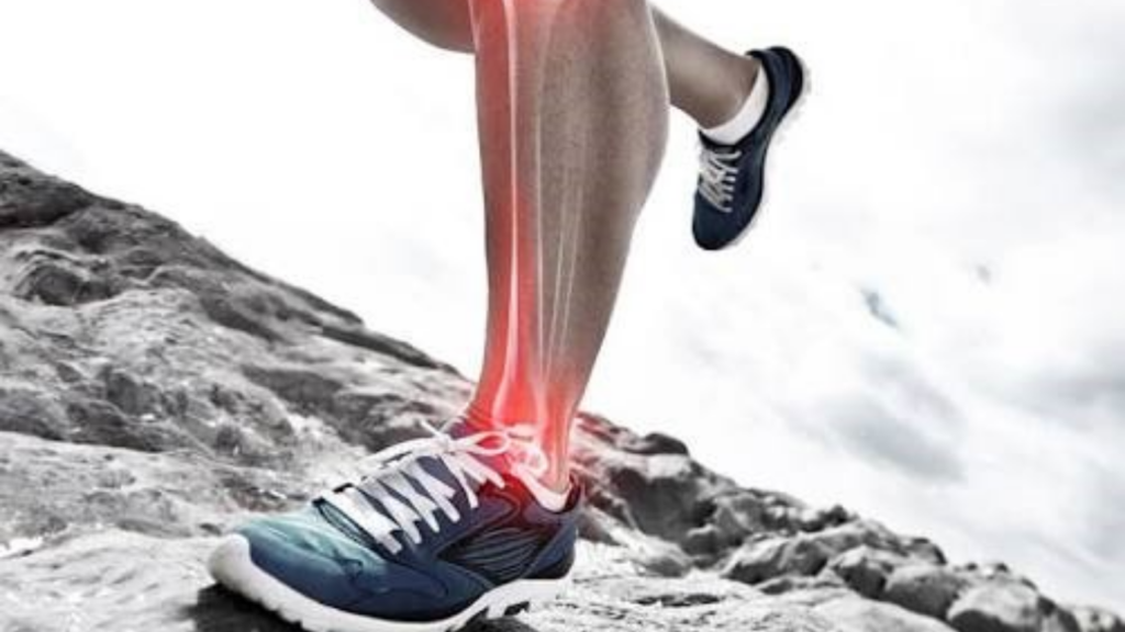 Koşucu bacağı sendorumu rahatsızlığının bölgesine ait bir görsel.